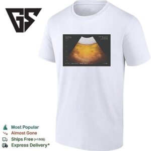 Beer Ultrasound Funny T-Shirt